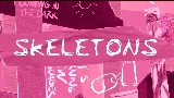 Miniatură video Skeletons